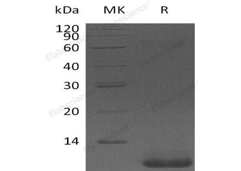 Recombinant Human Pro-Neuregulin-1/NRG1-β1 Protein (aa 176-246) - ABMIUM