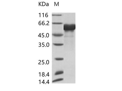 Recombinant AcmNPV Envelope glycoprotein gp64(His Tag) - ABMIUM