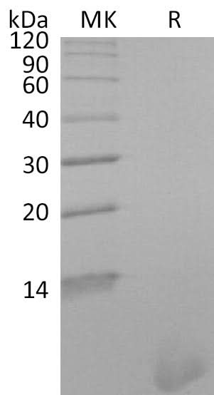 Recombinant SARS-CoV-2 S Protein HR1 - ABMIUM