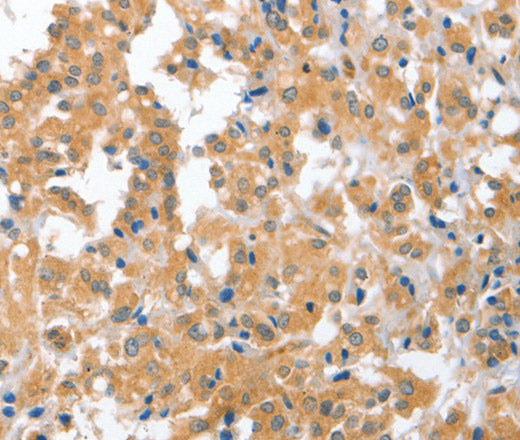 Anti-Human/Mouse CDR2 Antibody - ABMIUM
