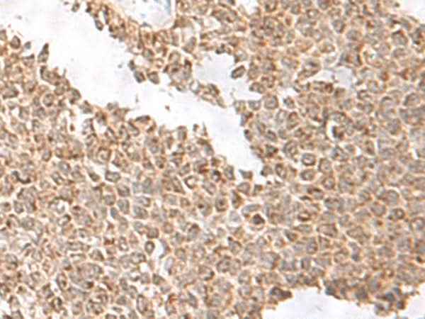 Anti-Human USP16 Antibody