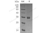 Recombinant Human SELENOI/EPT1 Protein (GST Tag) - ABMIUM