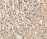 Anti-Human ROS1 Antibody - ABMIUM