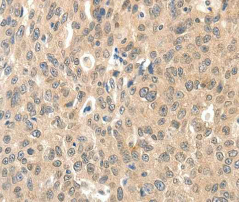 Anti-Human ROS1 Antibody