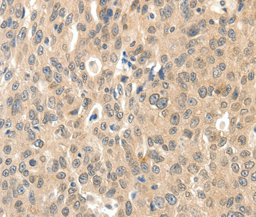 Anti-Human ROS1 Antibody - ABMIUM