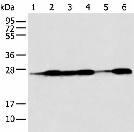 Western blot analysis of Human fetal muscle tissue HEPG2 Jurkat Hela A431 and A549 cell using BAG2 Polyclonal Antibody at dilution of 1:550
