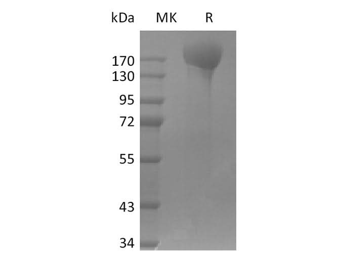 Recombinant SARS-CoV-2 ΔFVI-S trimer Protein(His Tag) - ABMIUM