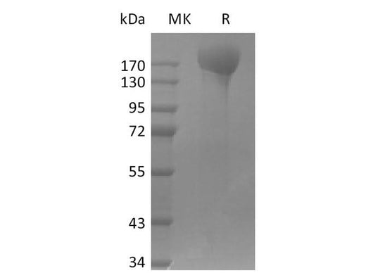 Recombinant SARS-CoV-2 ΔFVI-S trimer Protein(His Tag) - ABMIUM