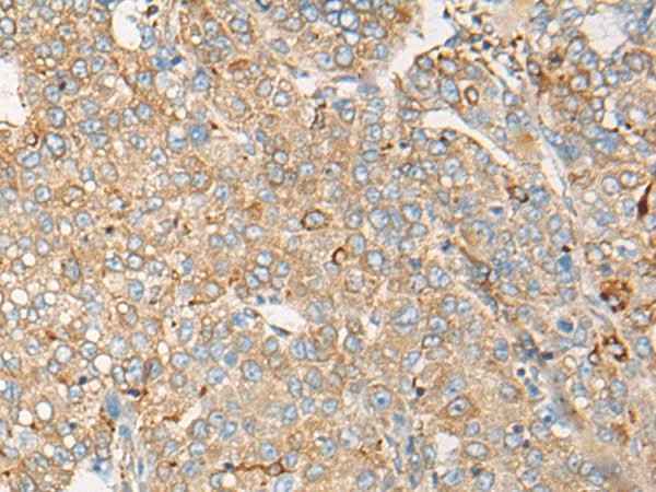 Anti-Human/Mouse/Rat CAPN9 Antibody