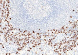 Anti-Human S100A8 Antibody [A1145] - ABMIUM