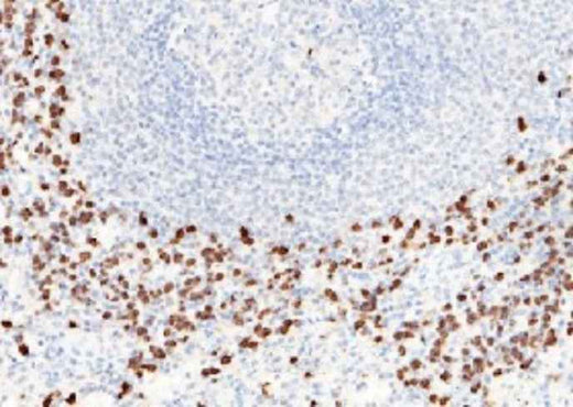 Anti-Human S100A8 Antibody [A1145] - ABMIUM
