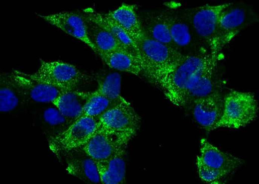 Anti-Human PIGR Antibody [A1190] - ABMIUM