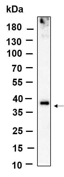 Anti-Human/Mouse/Rat BNI3L Antibody [B878] - ABMIUM