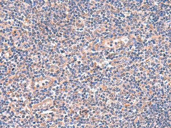 Anti-Human/Mouse OSBPL2 Antibody
