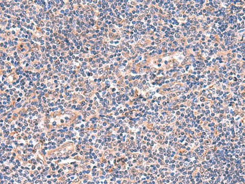 Immunohistochemistry of paraffin-embedded Human tonsil tissue using OSBPL2 Polyclonal Antibody at dilution of 1:55(×200)