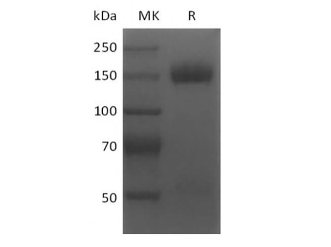 > 95 % as determined by reducing SDS-PAGE.