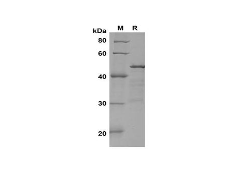 SDS-PAGE analysis of Rat IL-21 proteins, 2 μg/lane of ReCombinant Rat IL-21 proteins was resolved with SDS-PAGE under reducing conditions, showing bands at 45 kDa.