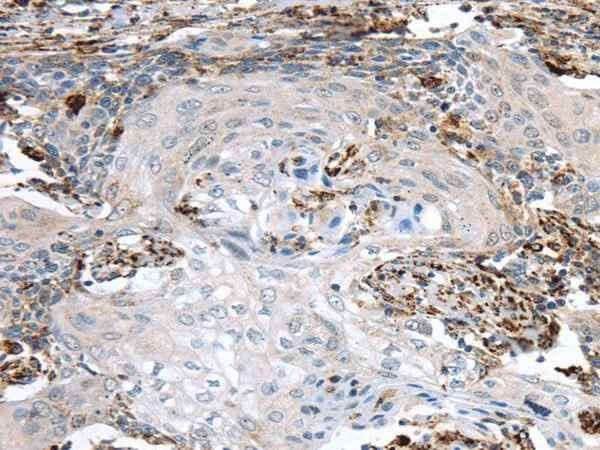Anti-Human TBXA2R Antibody