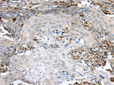 Anti-Human TBXA2R Antibody - ABMIUM