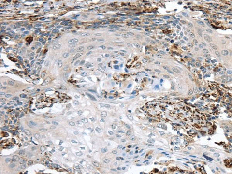 Anti-Human TBXA2R Antibody - ABMIUM