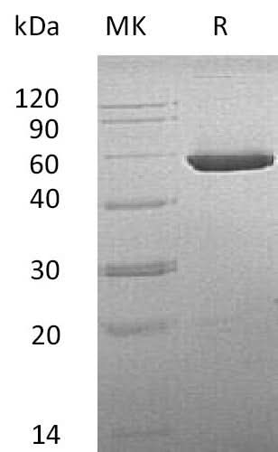Recombinant Mouse CNDP2/CPGL/PEPA Protein (His Tag) - ABMIUM