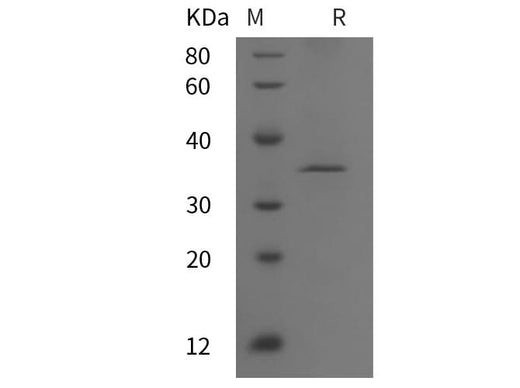 SDS-PAGE analysis of Human Apolipoprotein(a)/Lp(a) proteins, 2 μg/lane of Recombinant Human Apolipoprotein(a)/Lp(a) proteins was resolved with SDS-PAGE under reducing conditions, showing bands at 35 kDa.