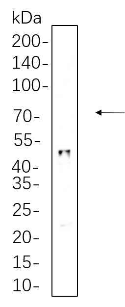 Anti-Human/Mouse/Rat HNF-3α Antibody [B670] - ABMIUM