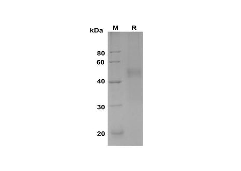 SDS-PAGE analysis of Human PLAUR proteins, 2 μg/lane of Recombinant Human PLAUR proteins was resolved with SDS-PAGE under reducing conditions, showing bands at 45 kDa.