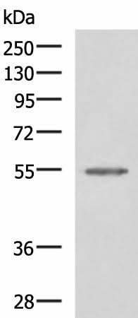 Western blot analysis of Jurkat cell lysate using SLC16A1 Polyclonal Antibody at dilution of 1:550
