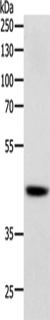 Anti-Human/Mouse SOX7 Antibody - ABMIUM