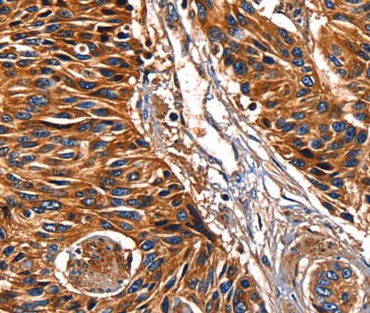 Anti-Human LGALS8 Antibody - ABMIUM