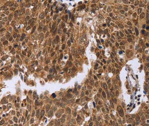 Anti-Human ERCC6L Antibody