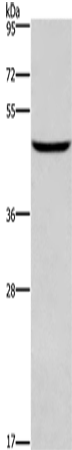 Anti-Human/Mouse/Rat DMRT3 Antibody - ABMIUM