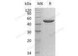 Recombinant Human Protamine-2/PRM2 Protein (His Tag) - ABMIUM