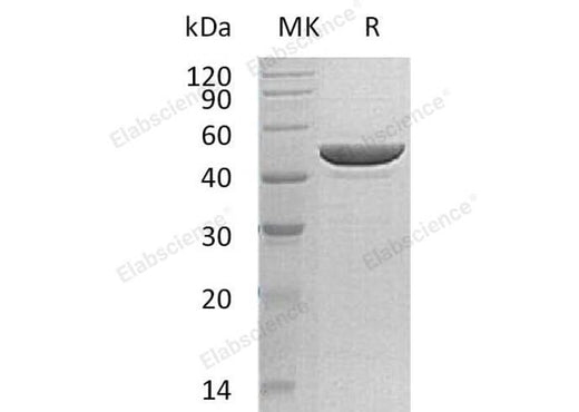 Recombinant Human Protamine-2/PRM2 Protein (His Tag) - ABMIUM
