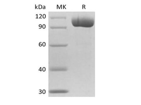 Recombinant Mouse FGCP/GCPII/mGCP/NAALADase I/PSMA(N-6His) - ABMIUM