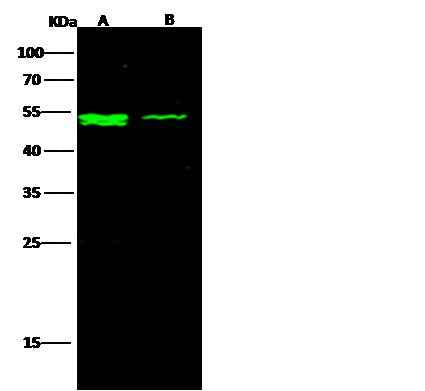 Anti-Human IFNAR2 Antibody [B249] - ABMIUM
