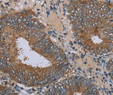 Anti-Human/Mouse/Rat IFRD1 Antibody - ABMIUM