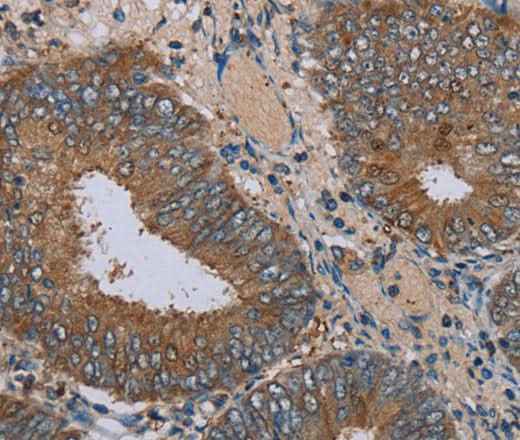 Anti-Human/Mouse/Rat IFRD1 Antibody