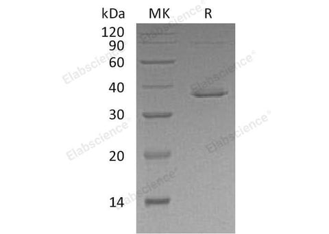 Recombinant Human STAT5B Protein (His Tag) - ABMIUM