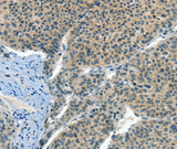 Anti-Human CRLF2 Antibody - ABMIUM