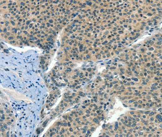Anti-Human CRLF2 Antibody
