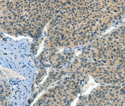 Anti-Human CRLF2 Antibody - ABMIUM