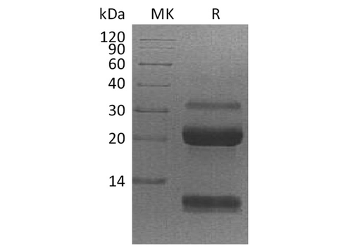 Recombinant Human Kallikrein 6/KLK6 Protein (His Tag) - ABMIUM