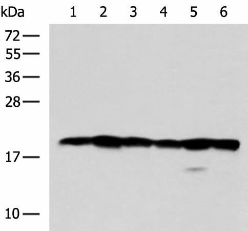 Western blot analysis of 293T Jurkat Hela and 231 cell lysates using BLOC1S6 Polyclonal Antibody at dilution of 1:600