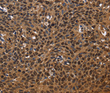 Anti-Human/Mouse EXTL3 Antibody - ABMIUM