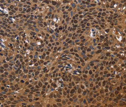 Anti-Human/Mouse EXTL3 Antibody