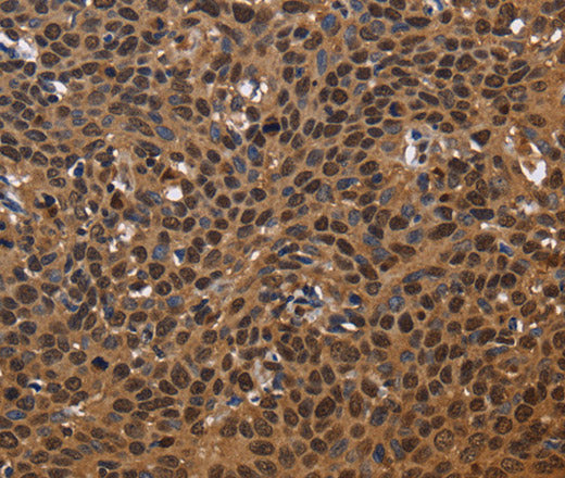 Anti-Human/Mouse EXTL3 Antibody - ABMIUM
