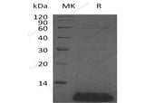 Recombinant Human β-Defensin 4A/DEFB4A Protein - ABMIUM