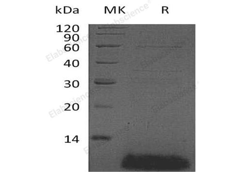 Recombinant Human β-Defensin 4A/DEFB4A Protein - ABMIUM